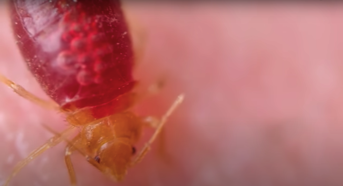 Everything You Need To Know About Bed Bugs Bed Bugs Hub   Bed Bug Drinking Blood 