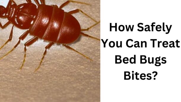 How-Safely-You-Can-Treat-Bed-Bug-Bites