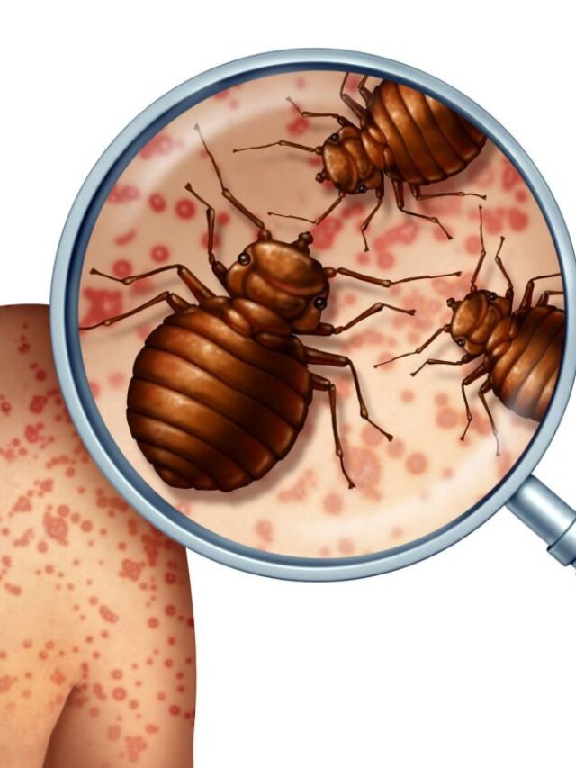 The Hidden Intruders: Unraveling the Mysteries of Bedbug Bites
